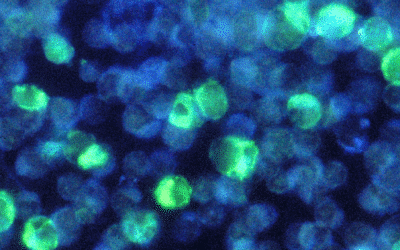 Capillary Electrophoresis (CE) versus quantitative Polymerase Chain Reaction (qPCR) for direct quantification of intact adenovirus particles