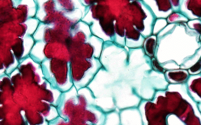 ICH Q14 Implementation: Expert Panel Discussion on Analytical Method Development